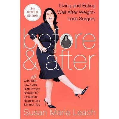 Before & After, Second Revised Edition - 2nd Edition by  Susan Maria Leach (Paperback)