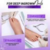 LOVELAY CREATIONS Nail Care Tool Kit - 3 of 4