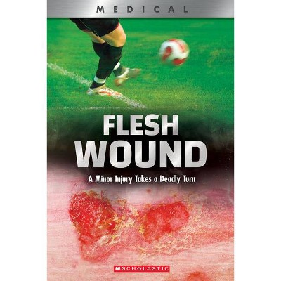 Flesh Wound (Xbooks) - (Xbooks: Medical) by  Shea Phillips (Paperback)