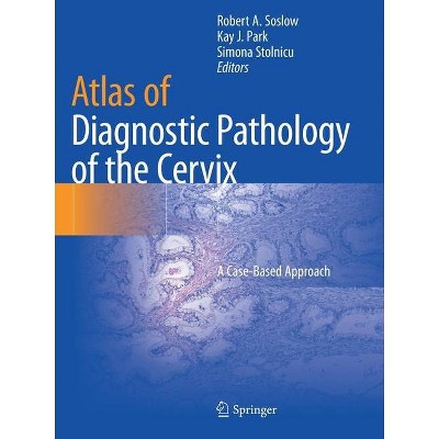 Atlas of Diagnostic Pathology of the Cervix - by  Robert A Soslow & Kay J Park & Simona Stolnicu (Paperback)