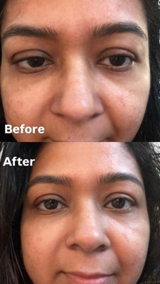 Guest review image 1 of 2, zoom in