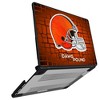 NFL AFC Teams Brick Wall Laptop Case for Apple MacBook - 2 of 4