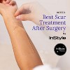 Rejuvaskin Scar Fx Silicone Sheets - 1.5" X 3" Breast Pair - 3 of 4
