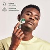Ultimate Skin Smoothing & Rejuvenation Kit - Precision Dermaplaning Hair Remover Tool, Pore Vacuum Blackhead Remover, and Micro Needle Derma Roller - 2 of 4