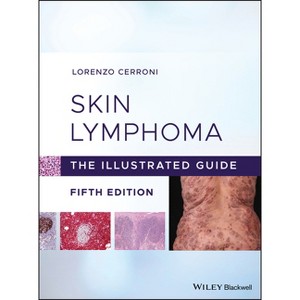 Skin Lymphoma - 5th Edition by  Lorenzo Cerroni (Hardcover) - 1 of 1
