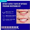 MySmile Prefilled Teeth Whitening Trays Kit, 12% Hydrogen Peroxide Tooth Whitening Trays - 2 of 4