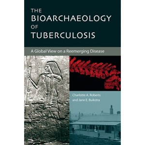 The Bioarchaeology of Tuberculosis - by  Charlotte Roberts & Jane Buikstra (Paperback) - 1 of 1
