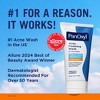 PanOxyl Maximum Strength Antimicrobial Acne Foaming Wash for Face, Chest and Back with 10% Benzoyl Peroxide - Unscented - 5.5oz - 3 of 4