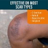 Nuvadermis Medical Grade Water Resistant Reusable Silicone Scar Sheets - Clear - 4ct - 4 of 4