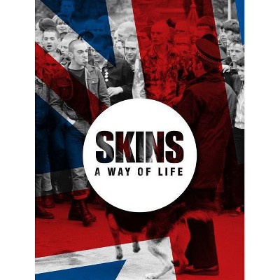 Skins a Way of Life - (Two Finger Salute) by  Patrick Potter (Hardcover)