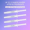 MySmile Premium 10 Min Teeth Whitening Kit with 28 LED Light, 35% CP Teeth Whitening Gel - 3 of 4