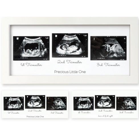 Best way to keep those precious ultrasound photos safe! #babyhacks #ex, ultrasound album