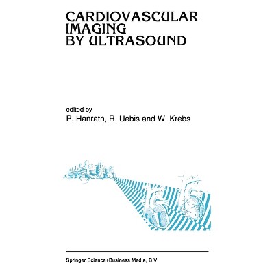 Cardiovascular Imaging by Ultrasound - (Boston Studies in the Philosophy of Science (Hardcover)) by  Peter Hanrath (Hardcover)