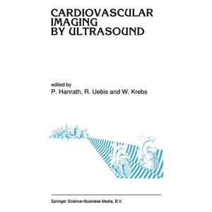 Cardiovascular Imaging by Ultrasound - (Boston Studies in the Philosophy of Science (Hardcover)) by  Peter Hanrath (Hardcover) - 1 of 1
