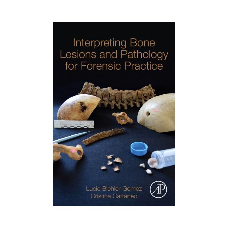 Interpreting Bone Lesions and Pathology for Forensic Practice - by  Lucie Biehler-Gomez & Cristina Cattaneo (Paperback), 1 of 2