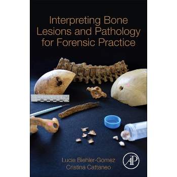 Interpreting Bone Lesions and Pathology for Forensic Practice - by  Lucie Biehler-Gomez & Cristina Cattaneo (Paperback)