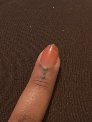 Guest review image 1 of 2, zoom in