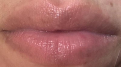 Guest review image 1 of 5, zoom in