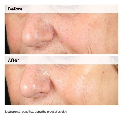 The Ordinary Alpha Arbutin 2% + Hyaluronic Acid for Hyperpigmentation - 1 fl oz - Ulta Beauty
