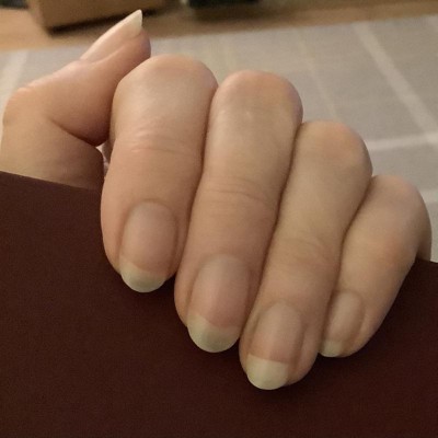 Guest review image 1 of 1, zoom in