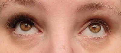 Guest review image 1 of 2, zoom in