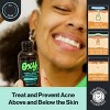 Oxy Hydrating Salicylic Acid Serum & Hyaluronic Acid Vitamin C Face Acne Serum - 1.25 fl oz - 4 of 4