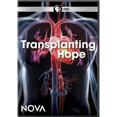 Nova: Transplanting Hope (DVD)(2018)