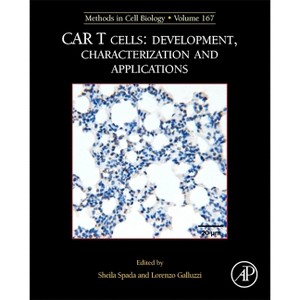 McB: Car T Cells: Development, Characterization and Applications - (Methods in Cell Biology) by  Lorenzo Galluzzi & Sheila Spada (Hardcover) - 1 of 1