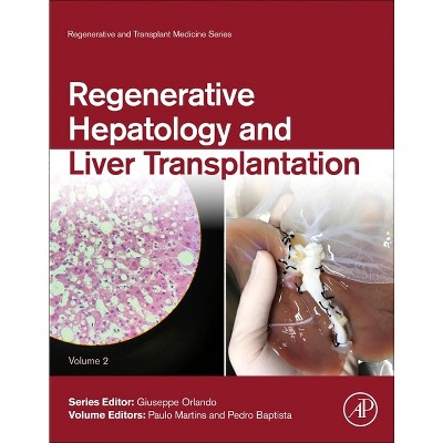 Regenerative Hepatology and Liver Transplantation - (Regenerative and Transplant Medicine) by  Paulo Martins & Pedro Baptista (Hardcover)