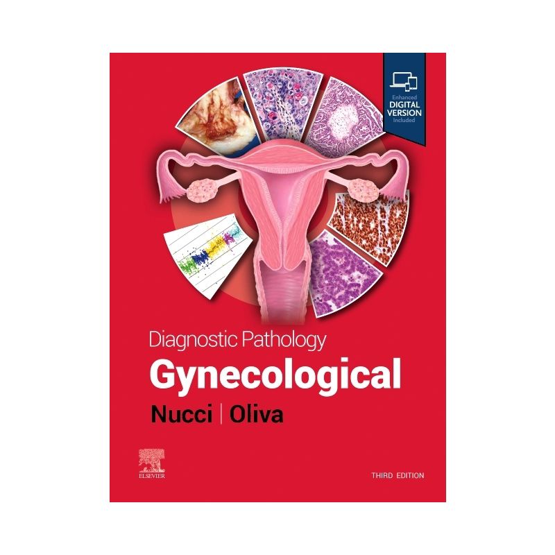 Diagnostic Pathology: Gynecological - 3rd Edition by  Marisa R Nucci & Esther Oliva (Hardcover), 1 of 2