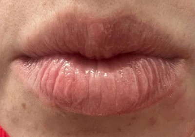 Guest review image 2 of 2, zoom in