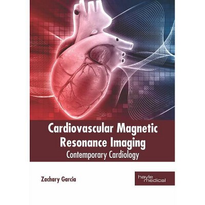 Cardiovascular Magnetic Resonance Imaging: Contemporary Cardiology - by  Zachary Garcia (Hardcover)