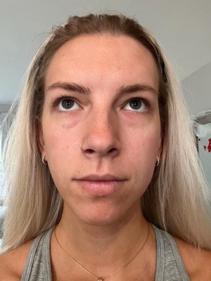 Guest review image 2 of 2, zoom in