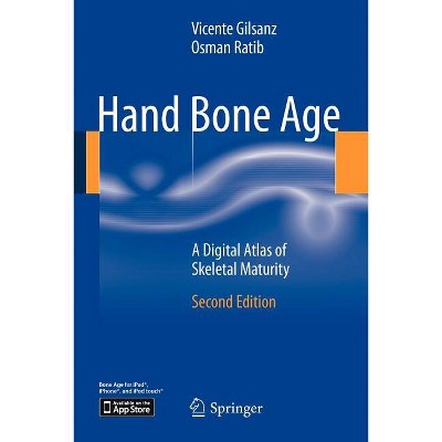 Hand Bone Age - 2nd Edition by Vicente Gilsanz & Osman Ratib (Paperback)