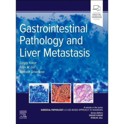 Gastrointestinal Pathology and Liver Metastasis: A Case-Based Approach to Diagnosis - (Surgical Pathology: A Case Based Approach to Diagnosis) - image 1 of 1