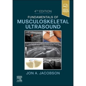 Fundamentals of Musculoskeletal Ultrasound - (Fundamentals of Radiology) 4th Edition by  Jon A Jacobson (Paperback) - 1 of 1