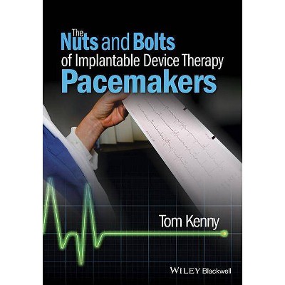 The Nuts and Bolts of Implantable Device Therapy - by  Tom Kenny (Paperback)