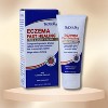 Triderma Eczema Fast Healing Cream (2.2 oz) - Face and Body Cream for Quick Eczema Relief - 2 of 2