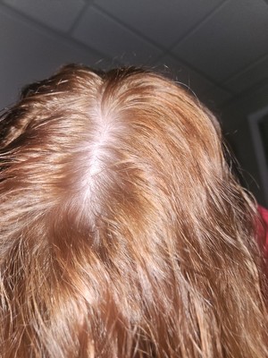 Guest review image 1 of 1, zoom in