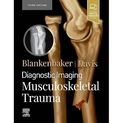 Diagnostic Imaging: Musculoskeletal Trauma - 3rd Edition,Annotated by  Donna Blankenbaker & Kirkland W Davis (Hardcover)