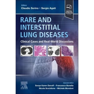 Rare and Interstitial Lung Diseases - by  Claudio Sorino & Sergio Agati (Paperback) - 1 of 1