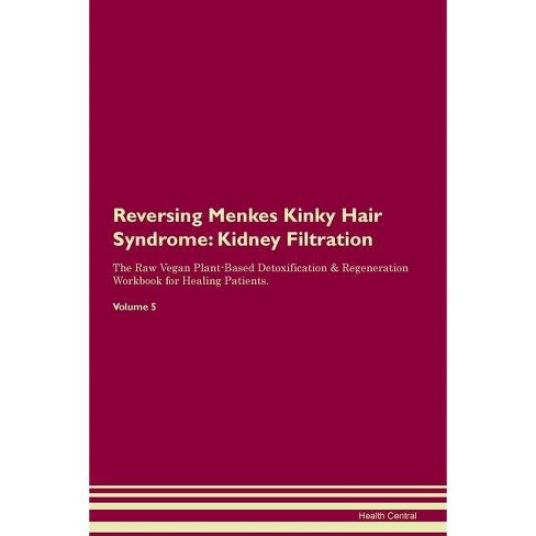 Reversing Menkes Kinky Hair Syndrome By Health Central