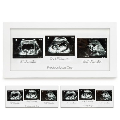 Image of KeaBabies Sonogram Picture Frame - Trio Ultrasound Picture Frames For New Mom, Sonogram Photo Frame (Alpine White)
