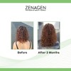 Zenagen Evolve Nourishing Shampoo (16 oz) and Evolve Nourishing Conditioner (16 oz) - XXL Hair DUO SET Kit - 2 of 3