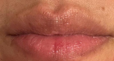 Guest review image 2 of 5, zoom in