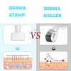 YEVYO Microneedles Derma Roller - Microneedling Stamp 0.25 mm, Micro Needle Skin Care Tool for Men and Women Home Use - White - 3 of 4