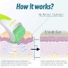 YEVYO Ice Roller for Face & Eye, Puffiness, Migraine, Pain Relief and Minor Injury - 4 of 4