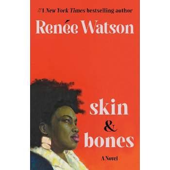 Skin & Bones - by  Renée Watson (Hardcover)