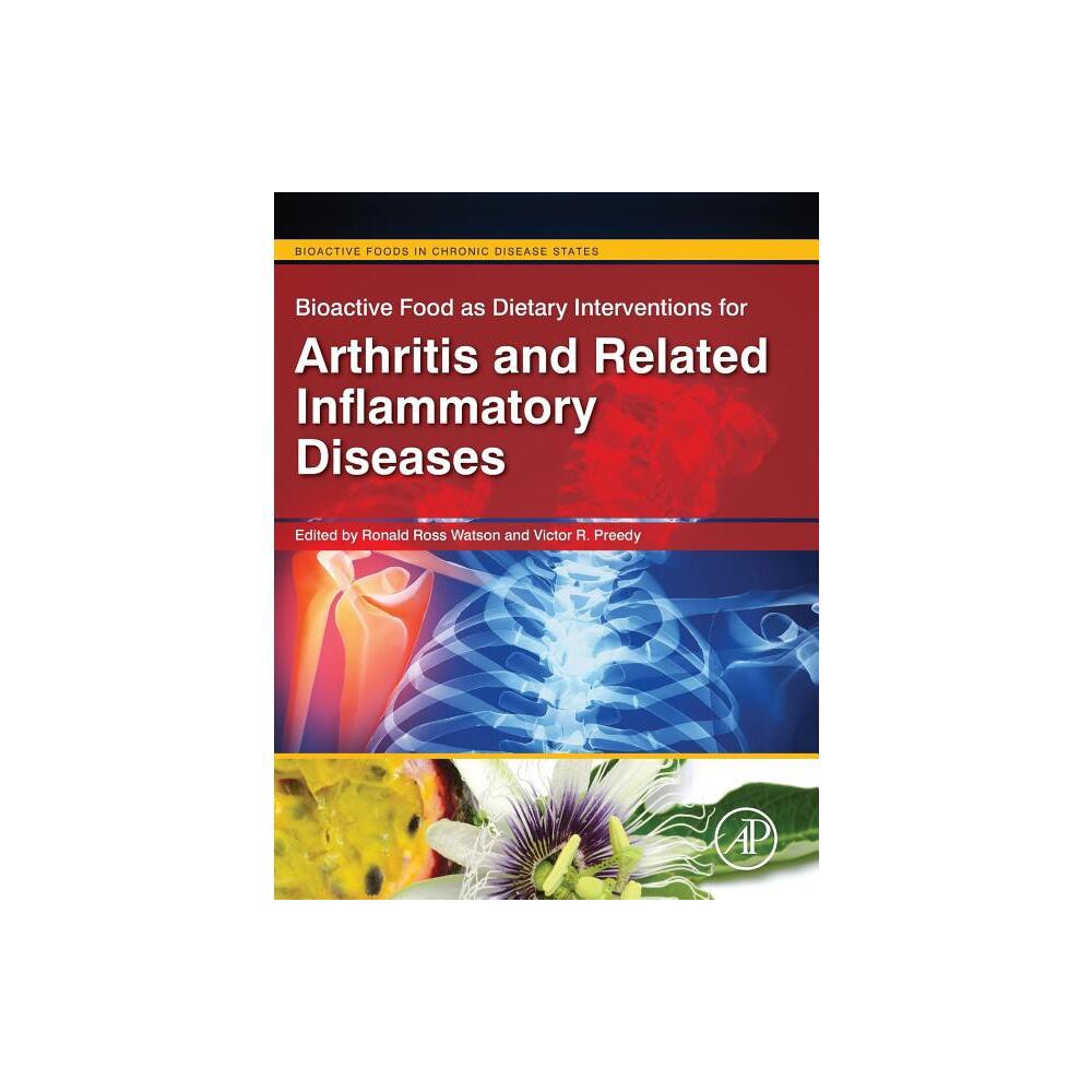 Bioactive Food as Interventions for Arthritis and Related Inflammatory Diseases - (Bioactive Foods in Chronic Disease States) (Hardcover)