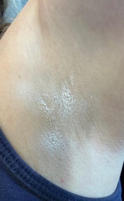 Guest review image 2 of 3, zoom in